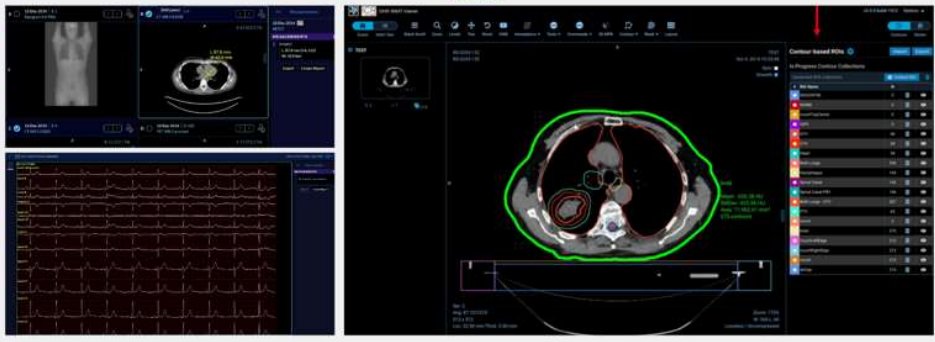 Frontier Viewer — Visor de Imágenes Médicas